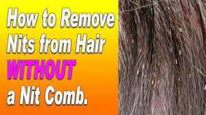 While the hair is still wet, comb the hair with small teeth comb. Howto How To Get Rid Of Lice Eggs Without Comb