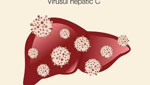 Maybe you would like to learn more about one of these? Hepatita C Tot Ce Trebuie Sa Stii Reginamaria Ro