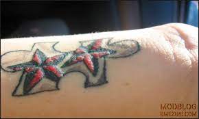 Tattoo Allergy Rash And Other Reactions To Ink Treatment More