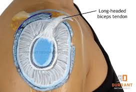 Image result for SLAP Lesion