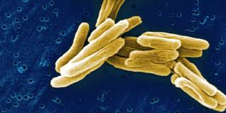 Ein antibiotikum sollte auch noch nach dem verschwinden der symptome und stets bis zum ende der packung eingenommen werden. Tuberkulose Antibiotika Resistenzen Nehmen Stark Zu Aponet De