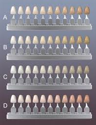 How Do I Know What Shade My Teeth Are There S No One Standard System In The Dental Field To Measure And Determine Tooth Co Veneers Teeth Dental Veneers Dental