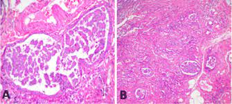 Anxiety can help motivate us to anticipate challe. Thoracic And Abdominal Mesothelioma In A Dog A Cytologist S View Springerlink