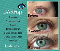Damage From Lash Extensions Lash4i Will Save The Day One Application Each Night For 16 Weeks And Longer Thicker Lashes A Long Thick Lashes Long Lashes Lashes