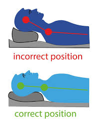 Pin On Headache Remedy And Relief