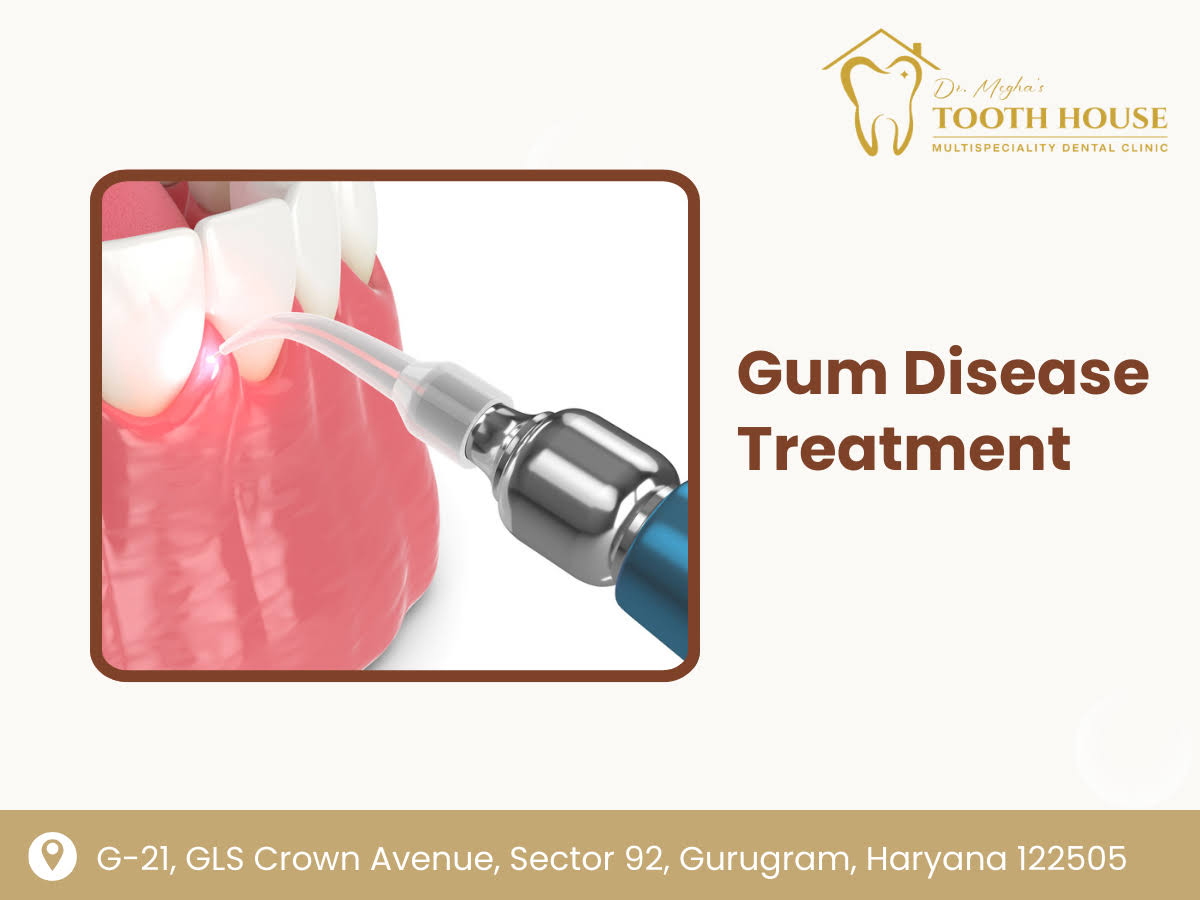Gum Disease Treatment product image
