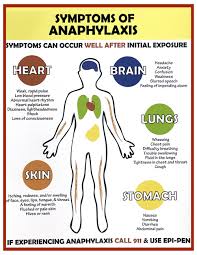 Image result for Anaphylaxis