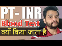 Pt Inr Test In Hindi Prothrombin Time International Normalize Ratio Explained