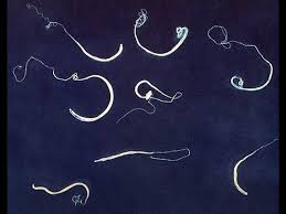 Image result for Whipworm