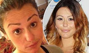 The number of people getting cosmetic procedures has risen steadily over the past five years and there are several reasons why. Jwoww Fights Back At Plastic Surgery Rumors With Makeup Free Photo Daily Mail Online