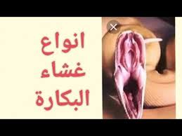 انواع غشاء البكارة وشكل غشاء البكارة بعد فضه بالصور على الطبيعة حصريا Types Of Hymen Youtube