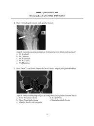 Terdapat 100 butir soal yang telah dilengkapi kunci jawabannya yang kami bagikan, dan dibawah ini merupakan kilas dari soal. Soal Uji Kompetensi Anatomi Radiologi