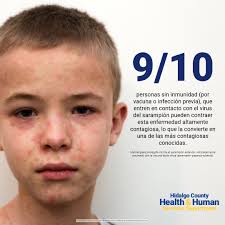 🚨Health Alert: Measles Outbreak in Gaines County, TX See details below.  #StayInformed