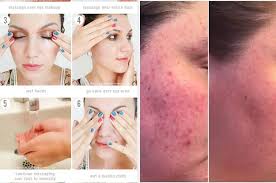 Emuaid.com has been visited by 100k+ users in the past month 23 Products Designed To Help You Get A More Even Skin Tone