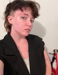 me cause even though i've been struggling my genuine sparkle is back in my  eyes and it feels great and looks amazing