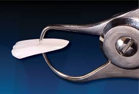 Then use a metal polisher to get scratches off your coated stainless steel appliance. Repair Don T Replace Part 1 Resurfacing An Existing Porcelain Fused To Metal Restoration With A Porcelain Veneer