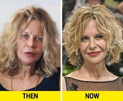 STOP With the Fillers”, Meg Ryan Attends Met Gala After 20 Years and Shocks  Fans