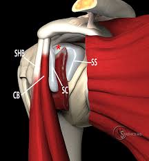 Cadaveric dissection of a right shoulder demonstrating the anatomic. Subcoracoid Bursa Radsource