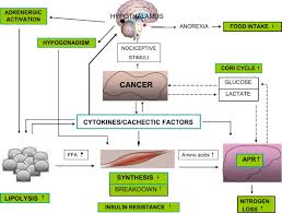 Image result for Cachexia in Cancer