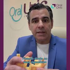 CONQUISTE seus dentes fixos aqui na Oral Unic Erechim através da técnica  dos IMPLANTES ZIGOMÁTICOS! Técnica utilizada principalmente por pessoas que  perderam todos seus dentes superiores! Com os ...