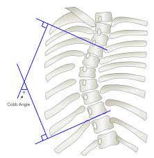 I have this sort of dull ache under my bottom rib on left hand side. Electronics Free Full Text Mobile Applications For Assessing Human Posture A Systematic Literature Review Html