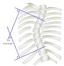 Lvlupfit.comwhat organ in just underbthe bottom left rib / therefore the organs in this area may be the cause of the pain. Electronics Free Full Text Mobile Applications For Assessing Human Posture A Systematic Literature Review Html