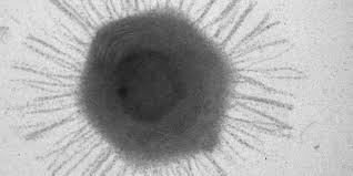 May 01, 2020 · then there is the allegation of an accidental release of a natural virus from a lab. Who Kasus Pertama Virus Marburg Yang Mematikan Ditemukan Di Afrika Barat Merdeka Com