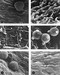 Image result for Aulacocalyx