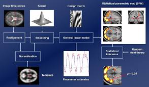 Spm international sweden spm instrument ab austria spm instrument int. Spm Statistical Parametric Mapping