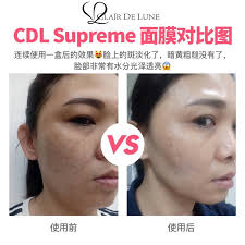 Find clair de lune from a vast selection of books. Buy Clair De Lune Supreme Repairing Mask 5 Pieces Box Online Eromman