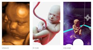 Is Using Vr Technology To Meet Your Baby Before It S Born The Future Of Ultrasound Core77