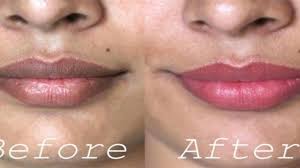 Maybe you would like to learn more about one of these? Masalah Bibir Hitam Tak Sangka Senang Saja Atasinya Remaja