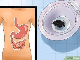 Image result for Blood in stool