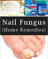 Home Remedies For Toenail Fungus Diy Cozy Home Toenail Fungus Home Remedies Remedies Home Remedies