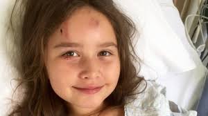 Annie Baxter's miraculous recovery after being hit by a car travelling at  80km/h