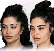 Antes e depois da Aline #BBB26 #fofocas #fofocadosfamosos #curiosidades