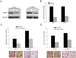 Prognosis is the outlook or chance of recovery from breast cancer. Plos One Foxm1 Is Associated With Poor Prognosis Of Non Small Cell Lung Cancer Patients Through Promoting Tumor Metastasis