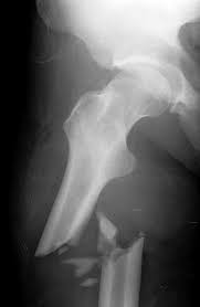 In this quiz, you will get to test out just how good of a radiologist you would make or do make. 520 Radiology Trivia And Musings Ideas Radiology Xray Humor X Ray
