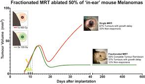 Learn what this means and how improved treatments are helping more people reach this goal. Cancers Free Full Text Complete Remission Of Mouse Melanoma After Temporally Fractionated Microbeam Radiotherapy