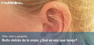 Bulto Detras De La Oreja Que Es Eso Que Tengo