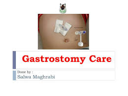 Ppt Gastrostomy Care Powerpoint Presentation Free Download Id 4497125