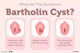 Image result for Bartholin's gland abscess