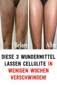 pin on hausmittel zur heilung