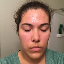 SKIN SECRETS BY DEBBIE