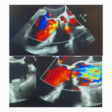 @fady_iskander's video Tweet