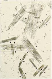 Image result for Indinavir