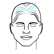 Hair Restoration with Stem Cell Therapy in Tijuana, Mexico