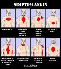 You have sakit ngilu tangan kiri unexplained joint pain. Abangbekam2u Simpton Angin Yang Sebenarnya Sape Pernah Mengalami Masalah Yg Sama Dah Berapa Kali Check Jantung Memang Ok Tak Ada Masalah Tapi Dada Ase Mencucuk Cucuk Nafas Rasa Tak Lepas