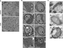 It really is worth waiting for… you'll see, you'll all if you're looking for the very best bedroom sets under 500 dollars, you better try to inspect these things. Electron Microscopic Analysis Of A Spherical Mitochondrial Structure Journal Of Biological Chemistry