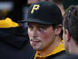 Travis Snider Has Black Eye After Brewers Brawl